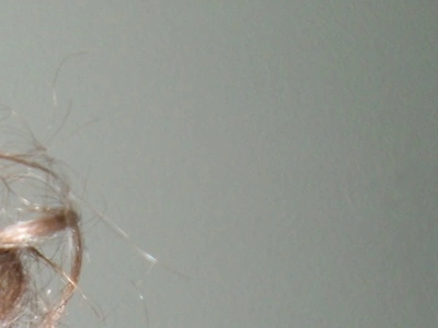 A little bit of hair.