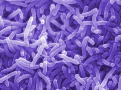 Cholera under a microscope.